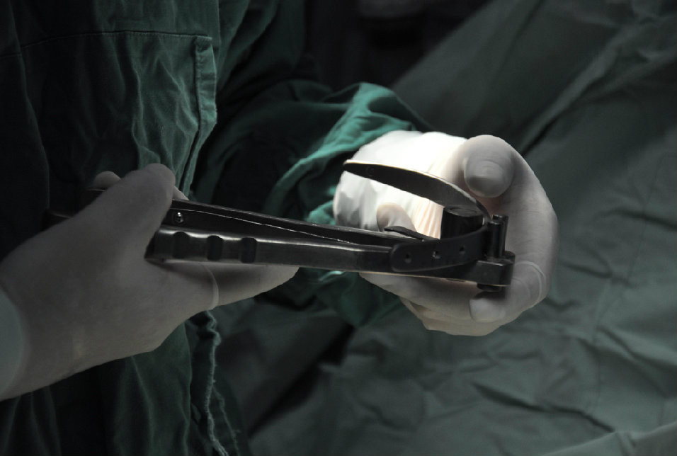 第三步：安装翻转器，根据患者凹陷程度调整钛板形状。